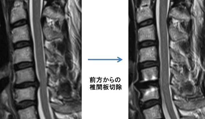 脊椎脊髄疾患 | 医療法人泰庸会 新潟脳外科病院
