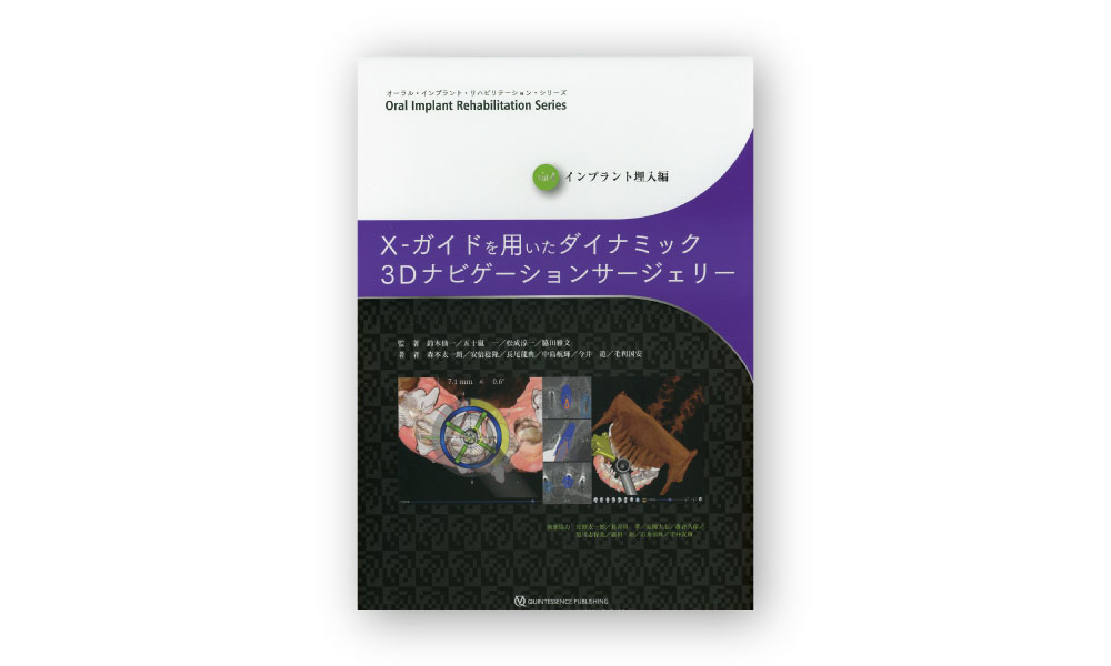 インプラント治療｜さがみ野駅徒歩1分の歯科医院
