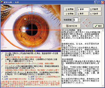 虹彩学でカラダの健康チェック！ 【日本虹彩学研究所】