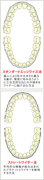 かない矯正歯科医院/装置の種類は？