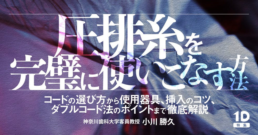 歯に優しいけどムズかしい、接着ブリッジの臨床論。デザイン・形成の