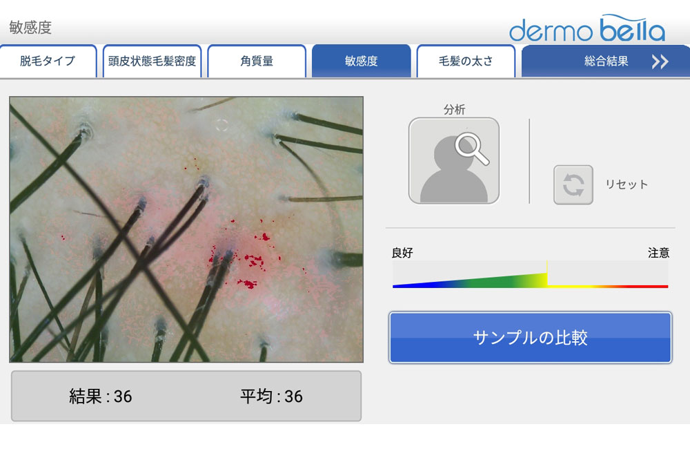 カウンセリングマイクロスコープ頭皮用 3R-WMBTPRIME-H | スリーアール