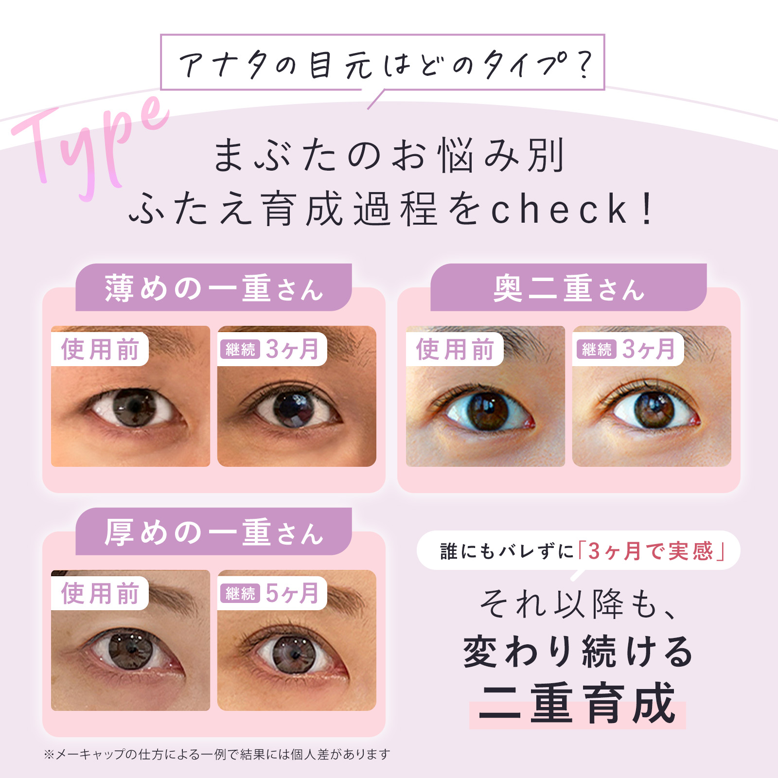 楽天市場】＼500円OFFクーポン配布中！／ナイトアイボーテ ナイトアイ