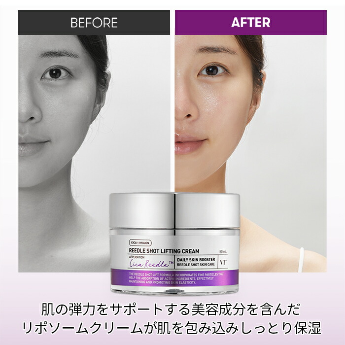 楽天市場】【VT公式】【 リードル ショット リフティング クリーム