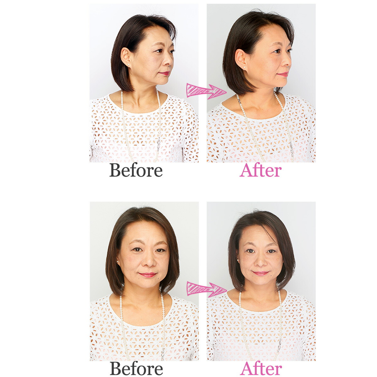 楽天市場】正規品 美ボディローラー(商品のみ) | SITERA シテラ403