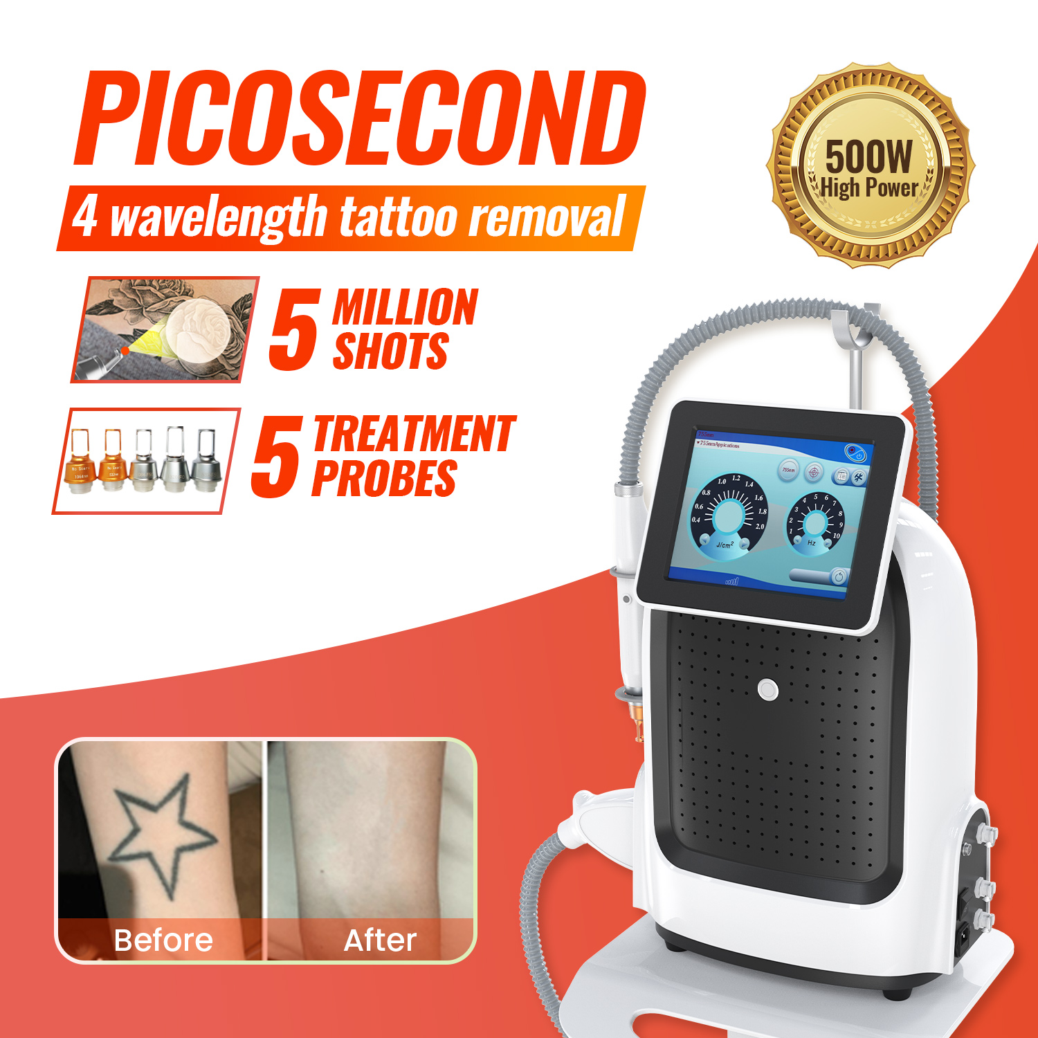 Laser Tattoo Removal Machine For Sale | Professional Nd: Yag