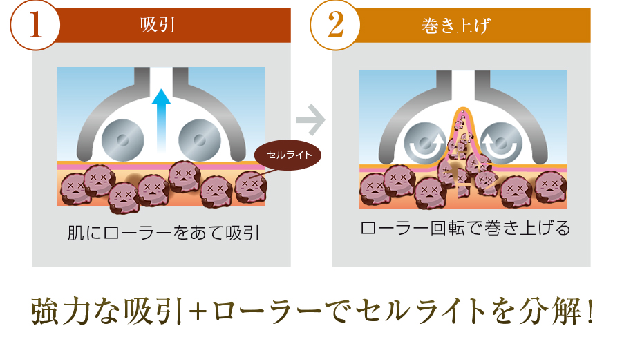 株式会社ワムのハイパーシェイプ®