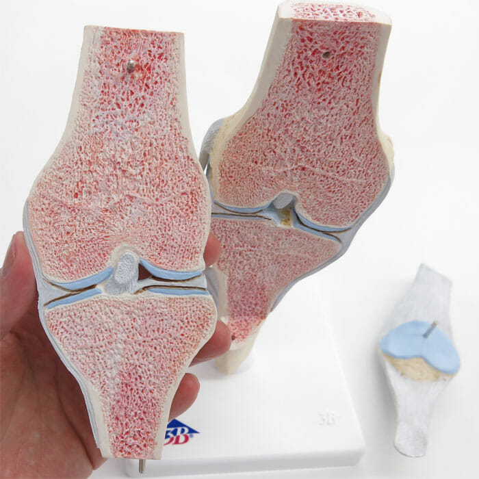 膝の関節断面，3分解モデル | 日本スリービー・サイエンティフィック