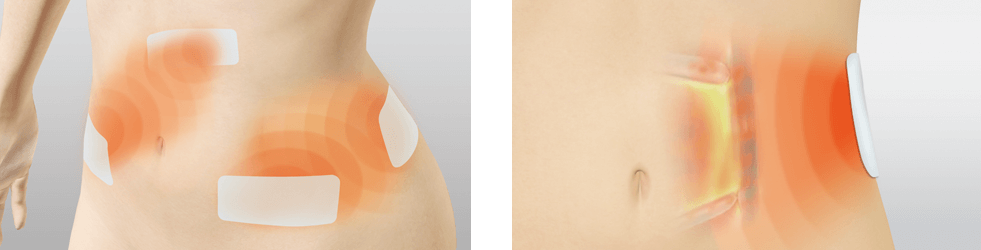 スタイリフト | ボディケア | 伊藤超短波 エステ関係者向けサイト