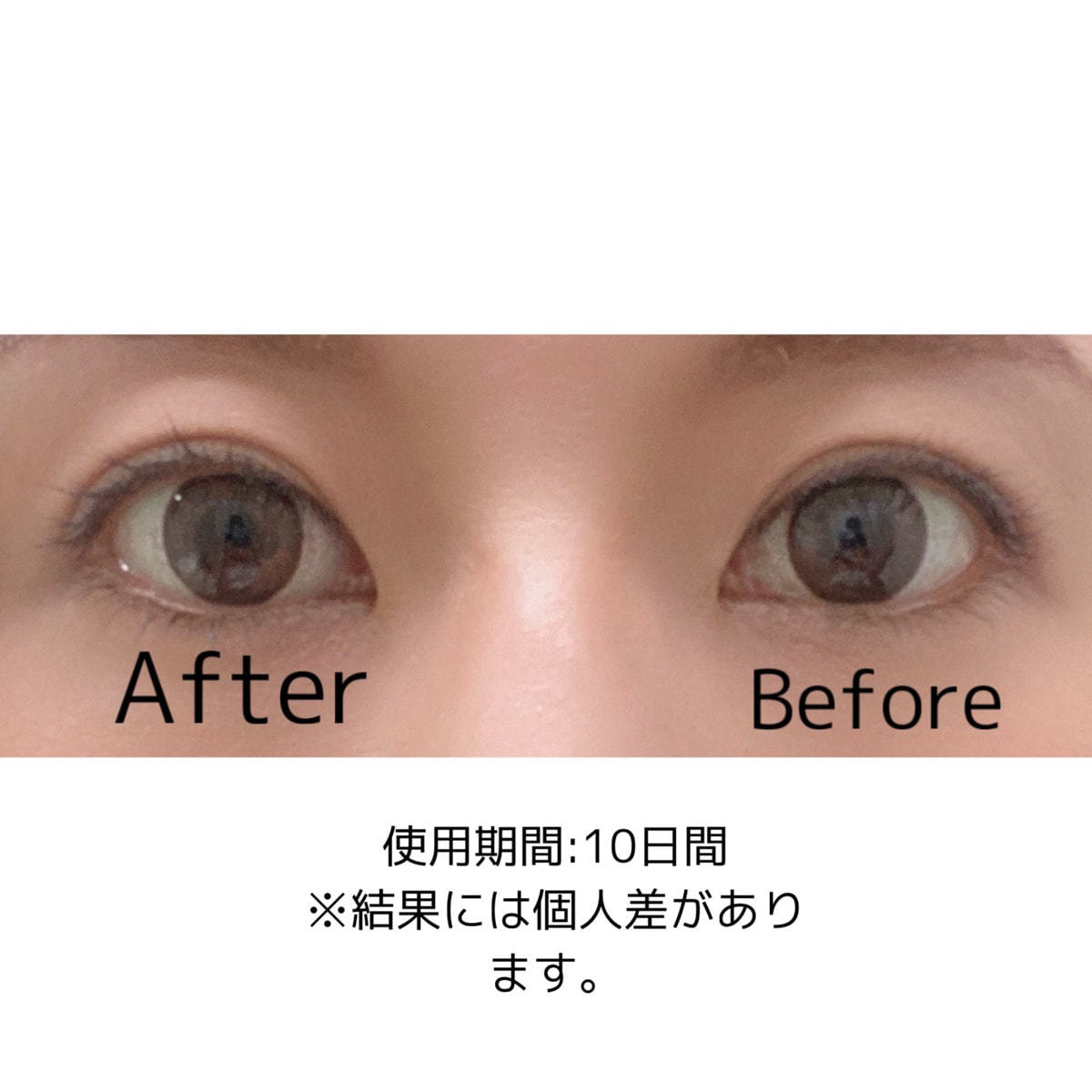 テラケア アイ 3mlの卸・通販 | ビューティガレージ