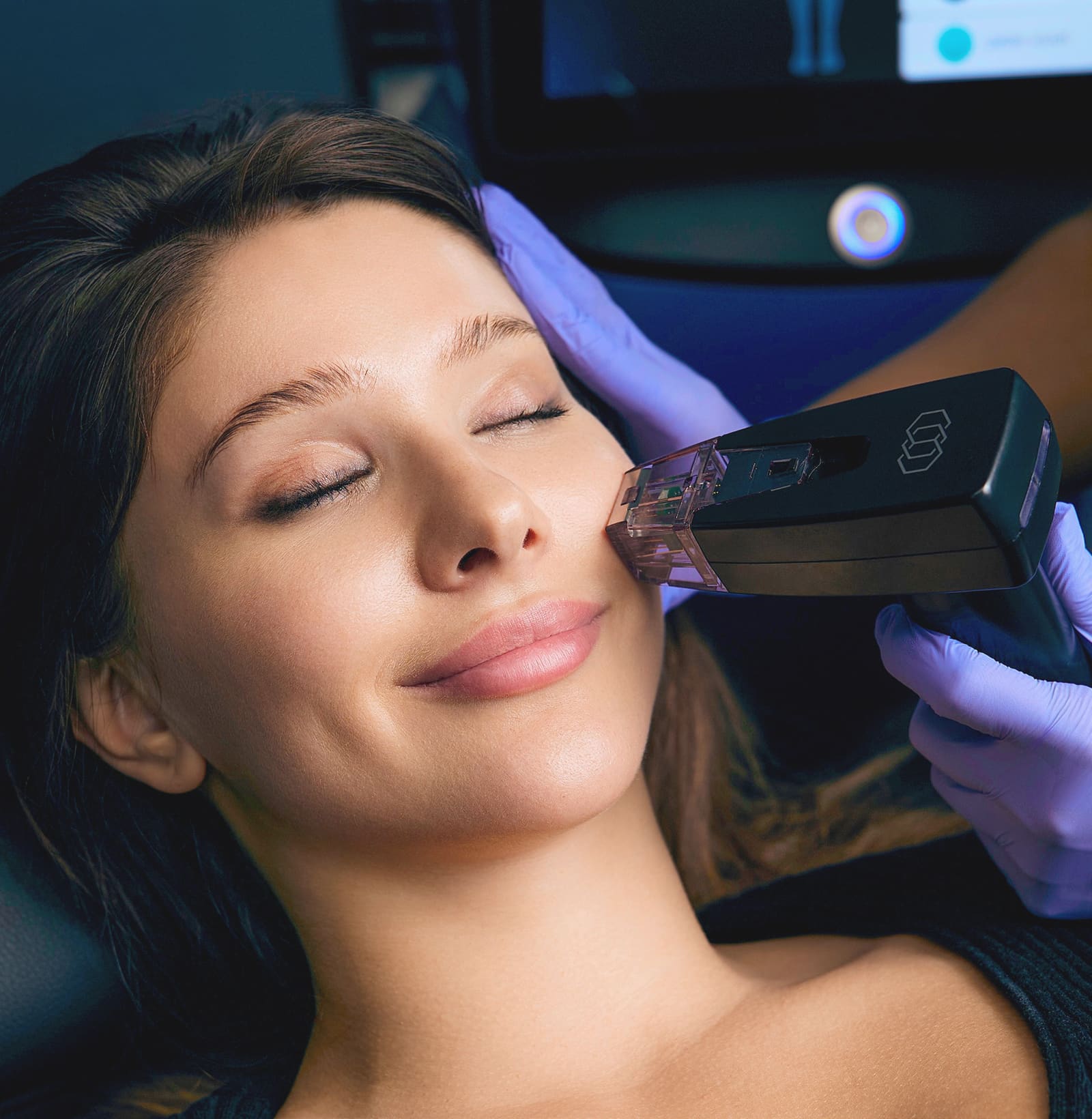 Morpheus8 in Larchmont, NY | StudioMD