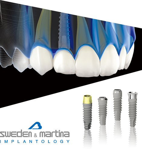 プラクティカル インプラントロジー 口腔インプラント実践臨床