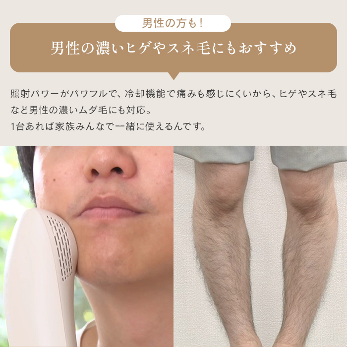 ステラボーテ IPL光美容器 Luna ディノスANAmall店