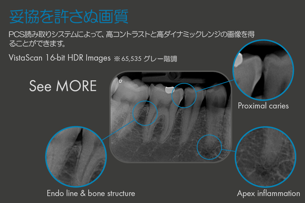 Dürr Dental｜VistaScan Mini View 2.0 IPスキャナー