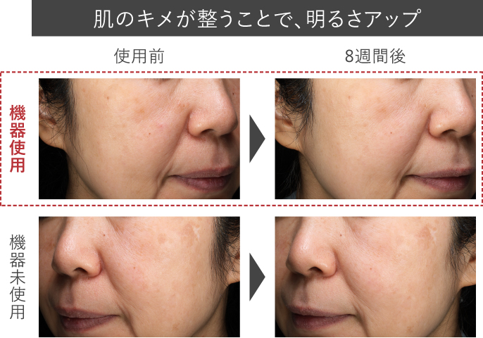 e-TREND｜パナソニック EH-SL85-W [光美顔器フォト ブライトショット]