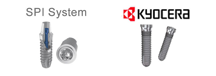 インプラント｜川島歯科クリニック｜東京都板橋区の歯医者。ときわ台