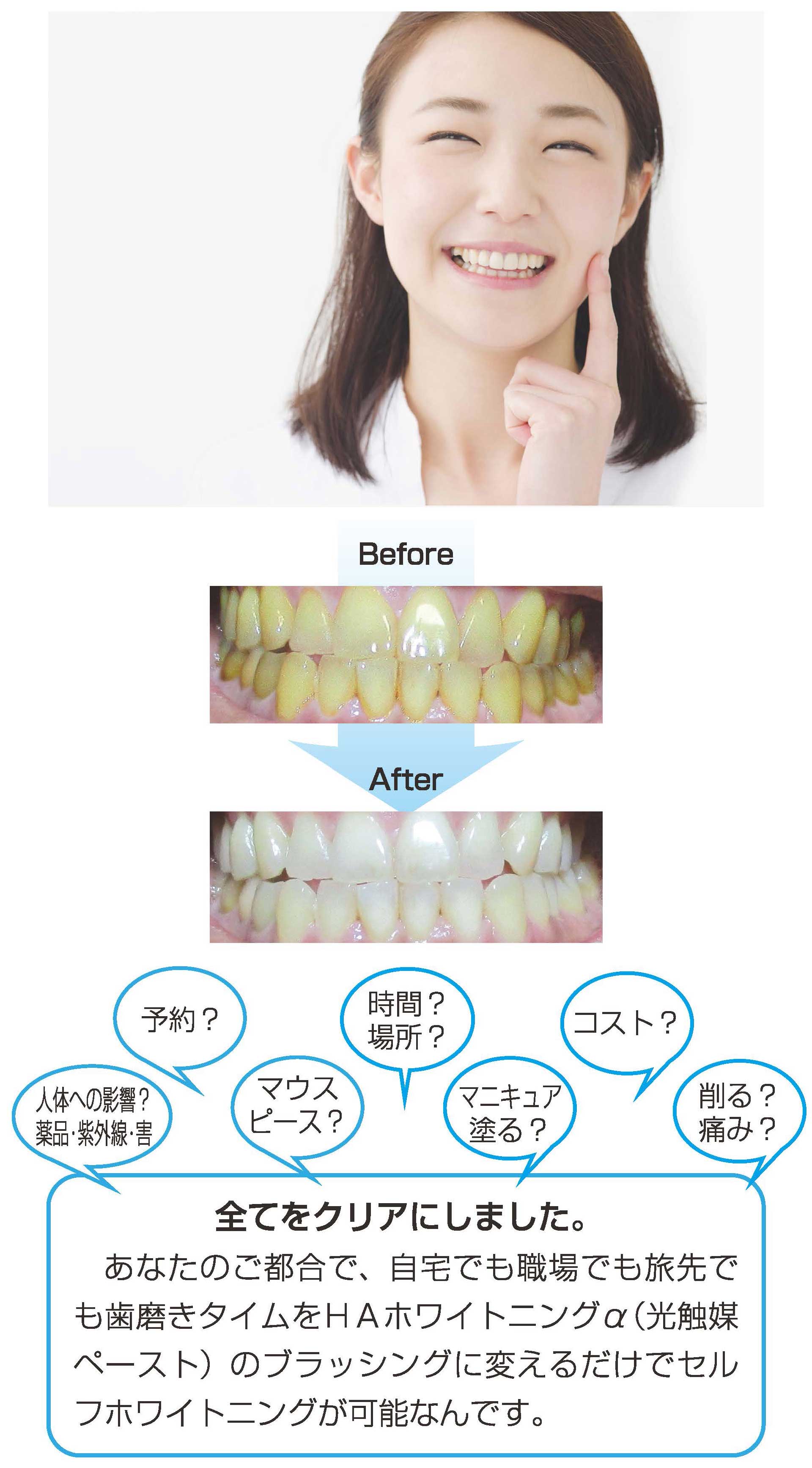 製品案内 HAホワイトニングα