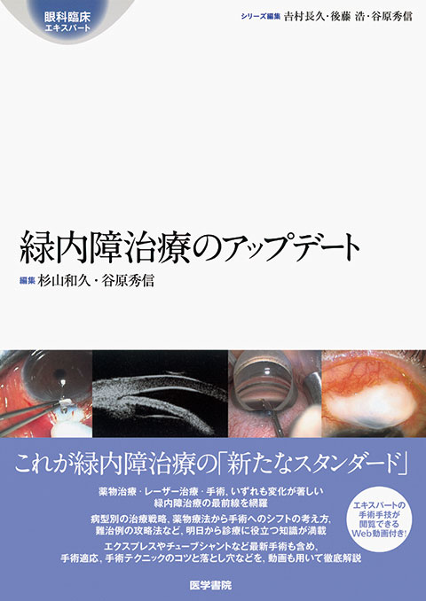 緑内障治療のアップデート | 書籍詳細 | 書籍 | 医学書院