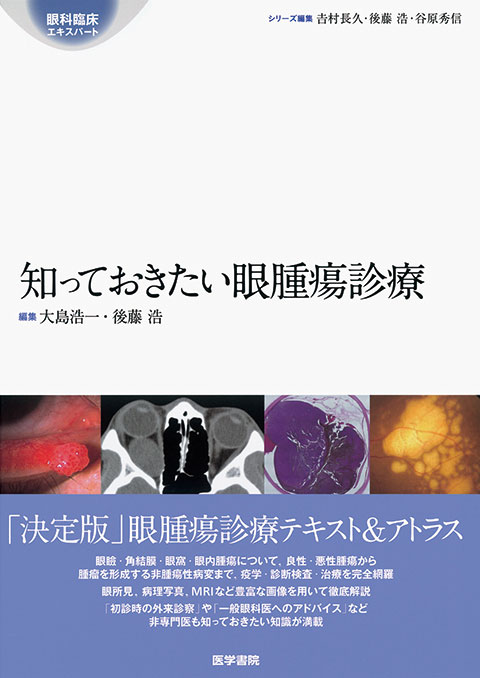 知っておきたい眼腫瘍診療 | 書籍詳細 | 書籍 | 医学書院