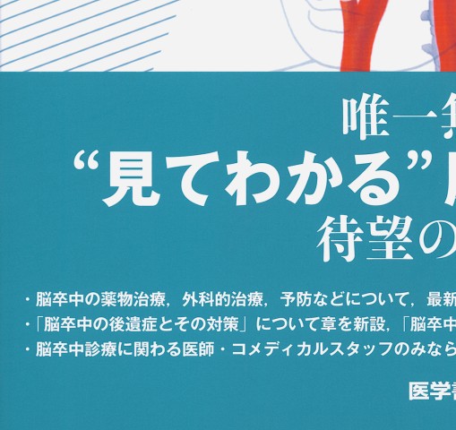 脳卒中ビジュアルテキスト_立ち読み