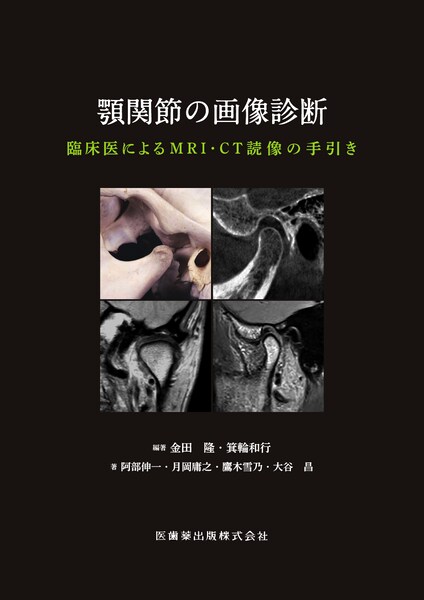 顎関節の画像診断 臨床医によるMRI・CT読像の手引き／医歯薬出版株式会社