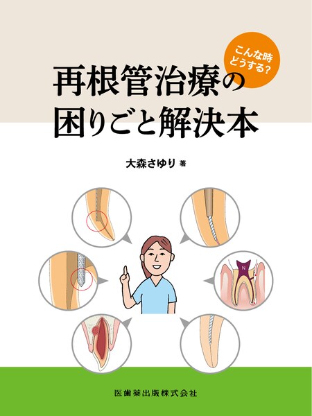 超音波”を攻略せよ ペリオドンタル・デブライドメント プラス1／医歯薬