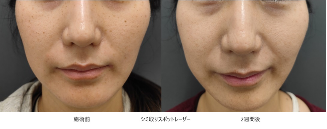 fb3e03d6678046cb7493ec5a6c0014