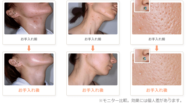 クロロフィル美顔教室 | 愛知県一宮市のコスメ・エステ・クロロフィル