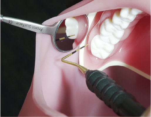 歯鏡| スリムネック両面ミラー（3P／4P） | 名南歯科貿易株式会社