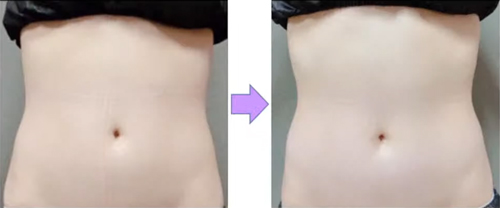 マッコイ NONF ノンエフ ドラゴン＋ボトルセット マッコイ NONF