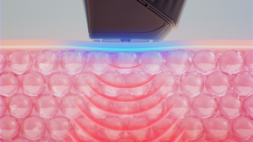高周波振動熱×冷却の同時アクションを実現した美顔器「ReFa DERMA HEAT