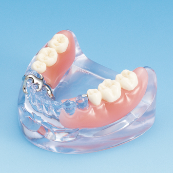 デンチャー比較模型 [PE-PRO005(ピンク) / PE-PRO009(クリア)]｜株式