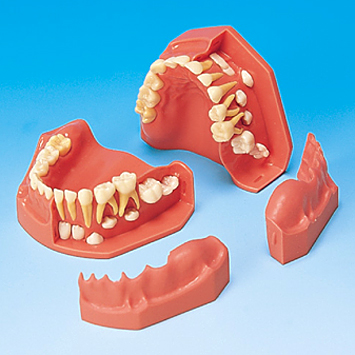 小児｜株式会社ニッシン｜歯科模型・歯科材料のトップメーカーとして