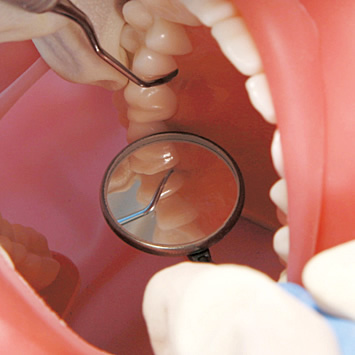 シンプルマネキンⅢ｜株式会社ニッシン｜歯科模型・歯科材料のトップ