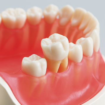 INVICTUS®アナトミーモデル [ANA3001-UL-JCP-ALM28]｜株式会社ニッシン