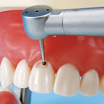 保存修復実習用顎模型 [D16FE-500E(GSF)](FE咬合器つき)｜株式会社