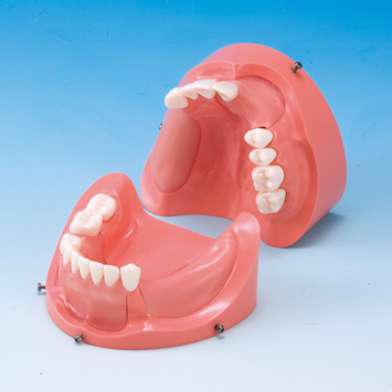 インプラント複合症例実習用顎模型(上顎) [P9-X.1143-U] (下顎) [P9-X