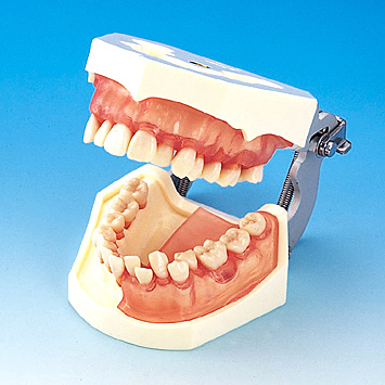 SRP実習用顎模型 [P15FE-X.770]｜株式会社ニッシン｜歯科模型・歯科