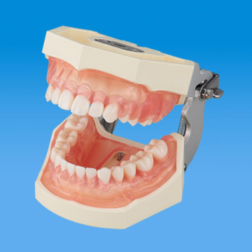 SRP実習用顎模型 [P15FE-500HPRO-S2B1-GSD]｜株式会社ニッシン｜歯科