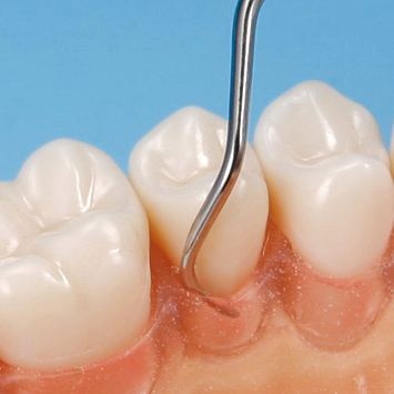 SRP用顎模型 [D16HD-500H(GSE)-MF](咬合器なし)｜株式会社ニッシン