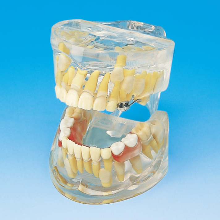 小児｜株式会社ニッシン｜歯科模型・歯科材料のトップメーカーとして