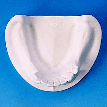 石こう製顎模型 [E3-各種]｜株式会社ニッシン｜歯科模型・歯科材料の