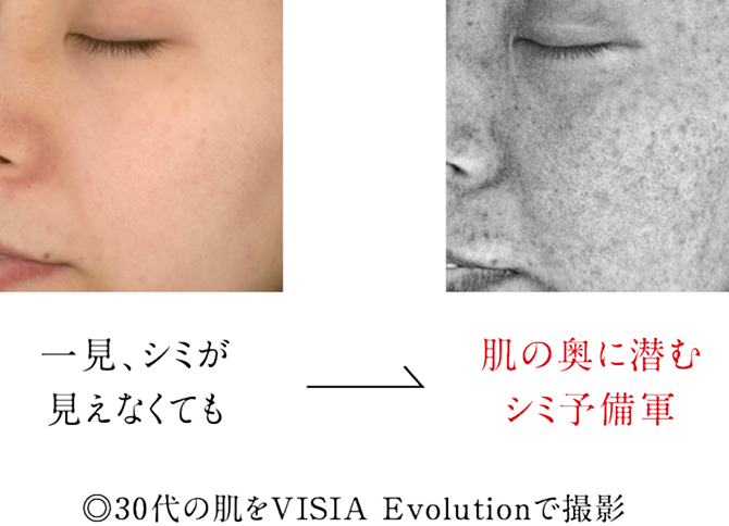 美活肌エキス】つけるのは「シミ」の部分だけで良いの？ | ドモホルン