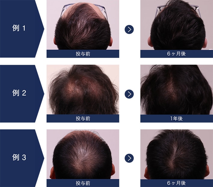 AGA・薄毛の内服薬・外用薬（薄毛薬）｜【公式】湘南AGAクリニック-AGA