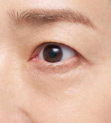 ナイトアイコルセット｜リバイタル（REVITAL）｜資生堂