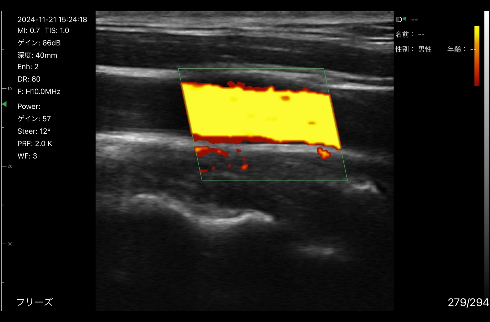 汎用超音波画像診断装置ポケットエコー miruco CL5
