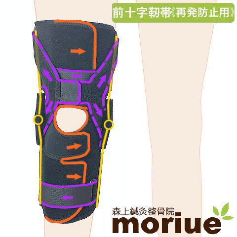 楽天市場】【前十字靭帯】《再発予防用》膝サポーター｜エクスエイド