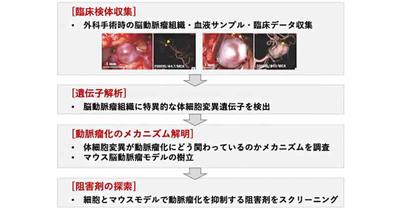 脳動脈瘤発生に重要な体細胞遺伝子変異を発見 | 理化学研究所