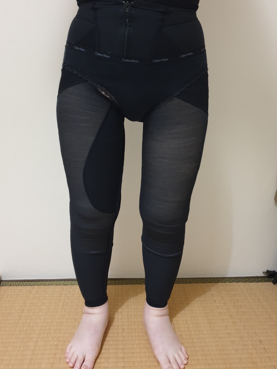 脂肪吸引のダウンタイム・圧迫・早く治す過ごし方【写真あり】 - 横浜院