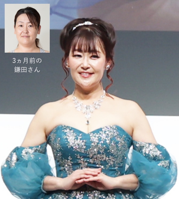 第32回たかの友梨エステティックシンデレラ大会2026 美変身コロシアム